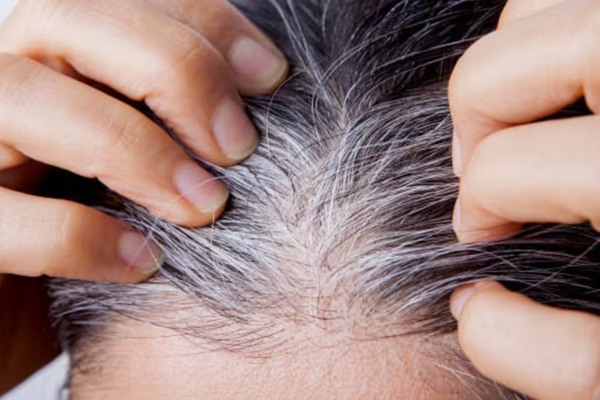 Zbogom sijedoj kosi zauvijek: Domaća boja za kosu na bazi cimeta koja ih skriva u trenu i daje mnogo sjaja detail 1