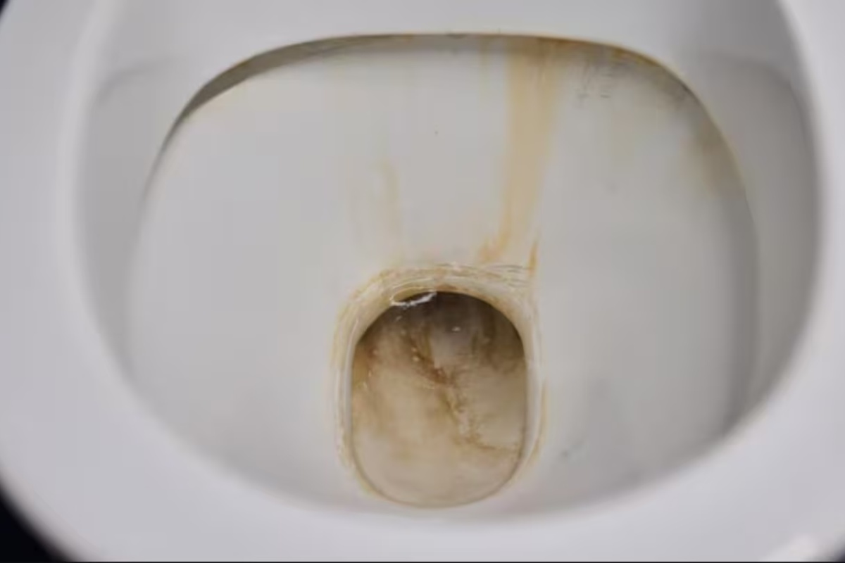 Ni izbjeljivač ni soda bikarbona: najbolji način za uklanjanje mrlja s umivaonika i toaleta detail 1