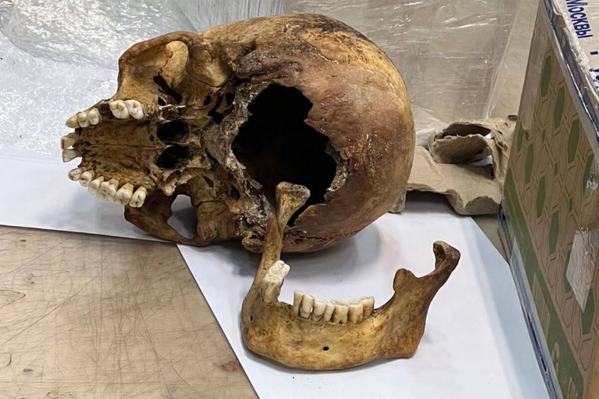 Fosilni zubi i moždani modeli otkrivaju da je olovo bilo dio okoliša u kojem su evoluirali ljudi detail 1