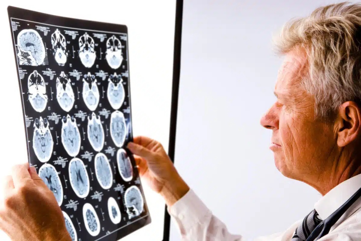 Duboki san igra ključnu ulogu u Alzheimerovoj bolesti, potvrđuju znanstvenici detail 1