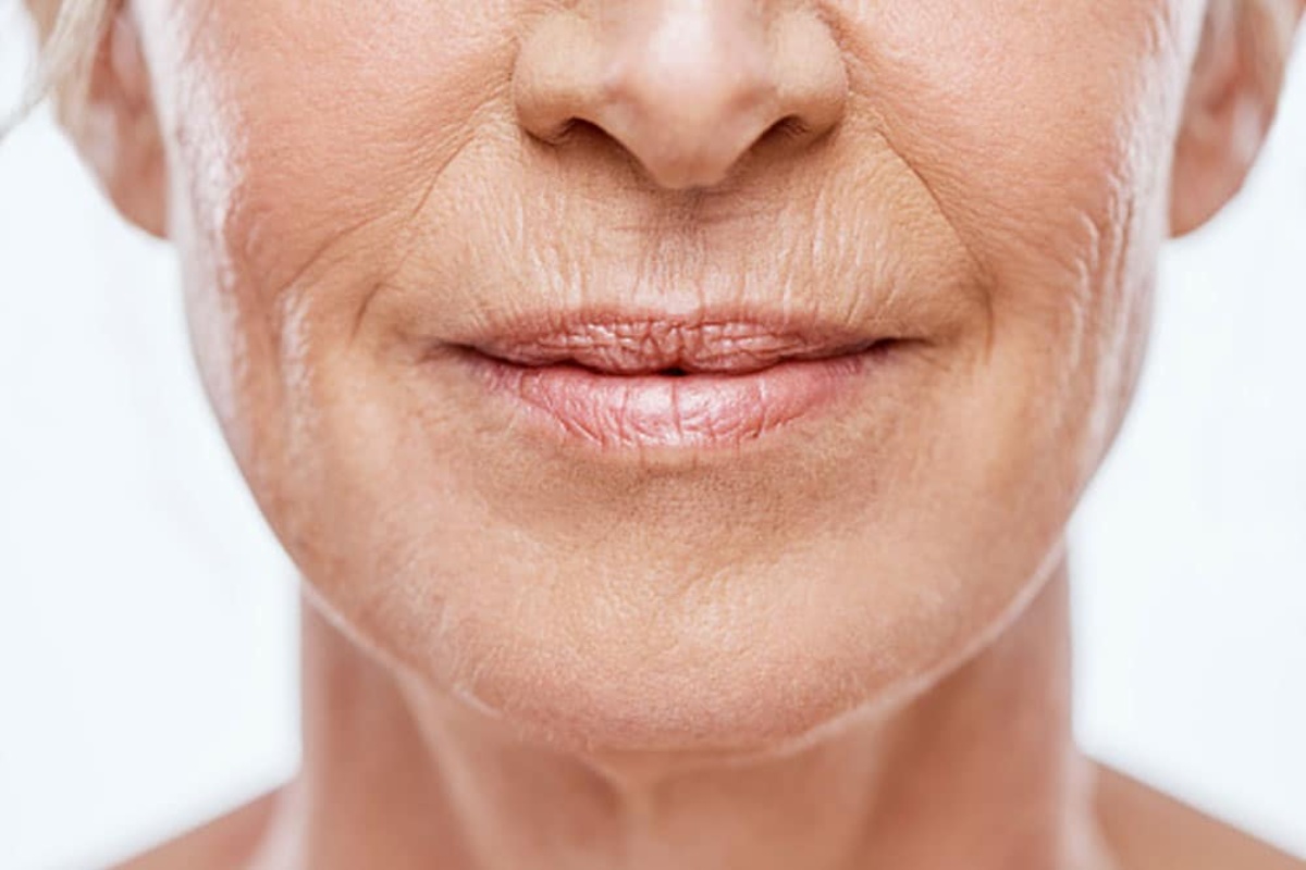 Ni kreme ni kućni pripravci: tajna za zaglađivanje kože i smanjenje bora na licu nakon 40-te detail 2