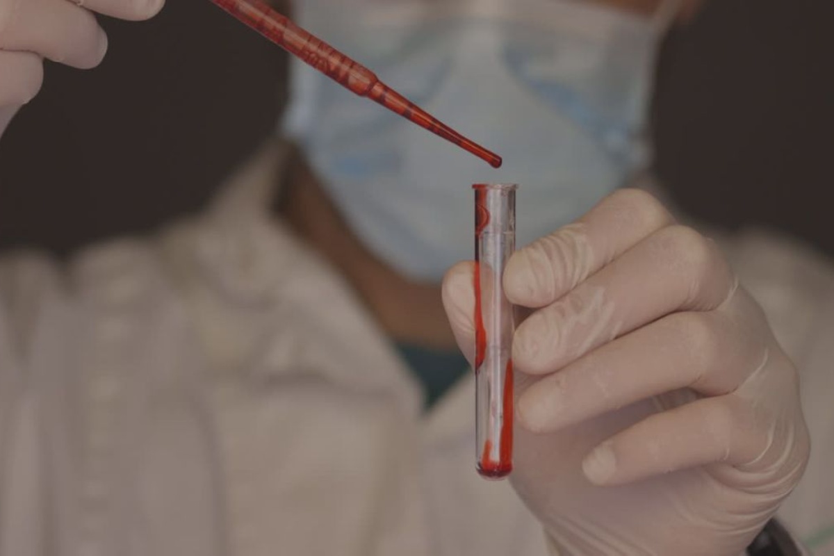 Kako intenzivan trening stimulira transport ključnih hormona u teško dostupna tkiva detail 2