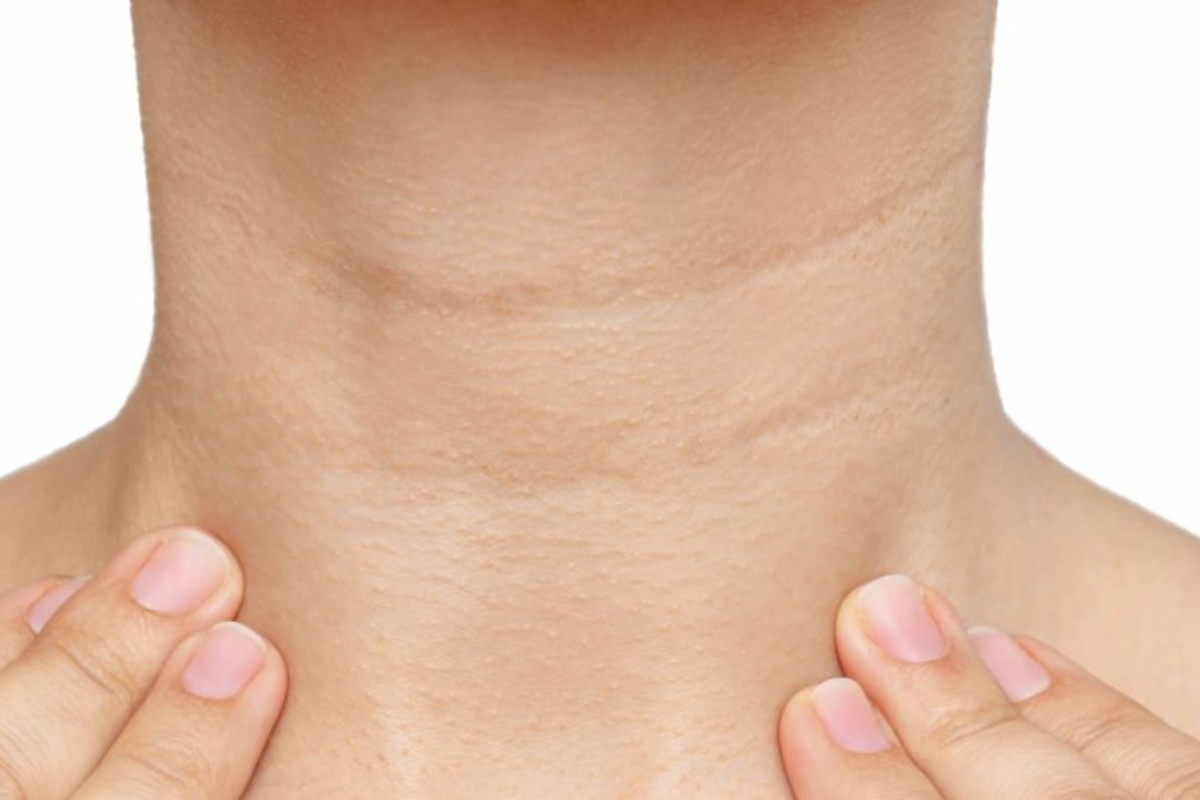 Kako koristiti želatinu za vraćanje čvrstoće kože vrata? detail 2