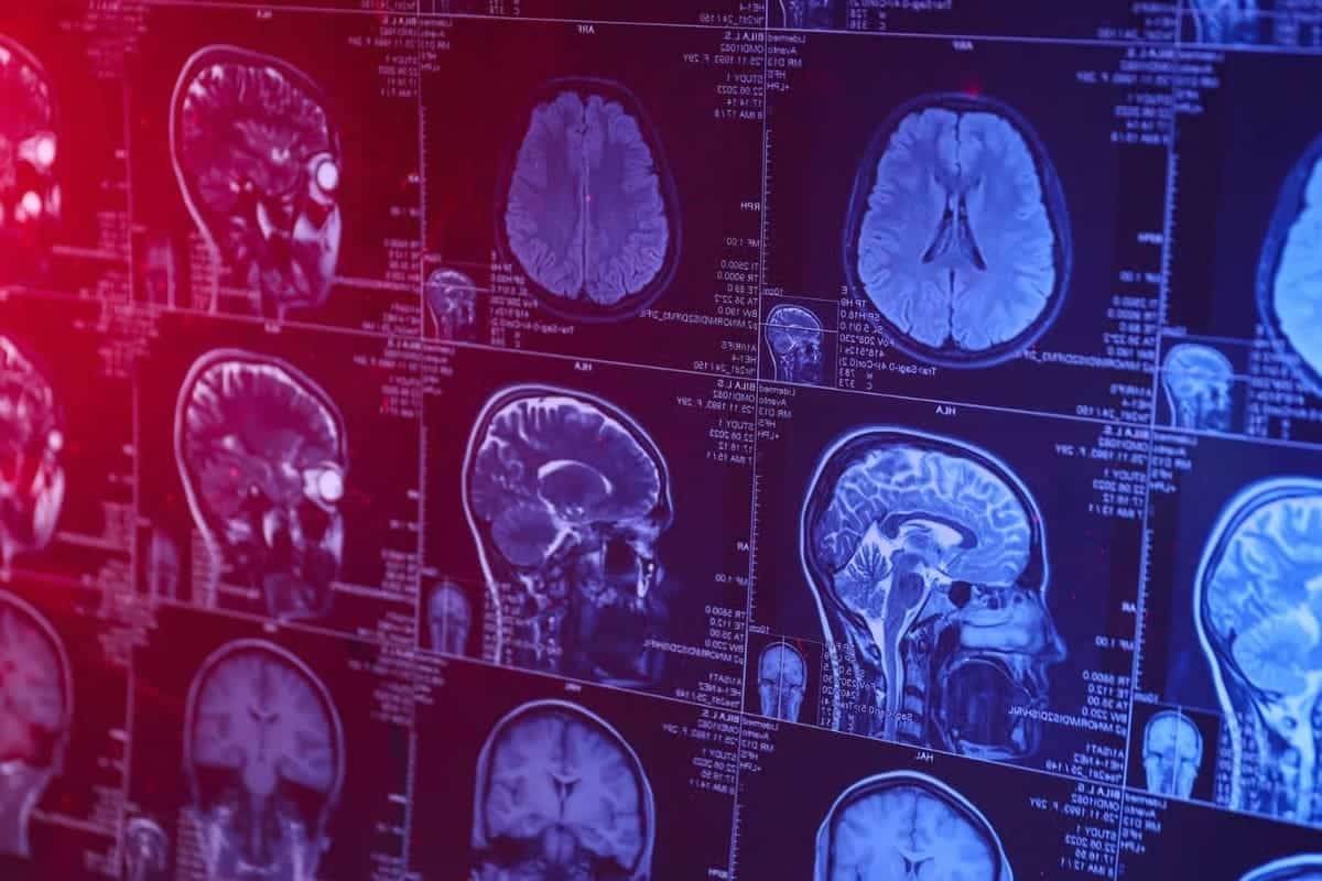 Studija osporava klasičnu teoriju o organizaciji moždane kore i preispituje funkcioniranje neurona detail 2