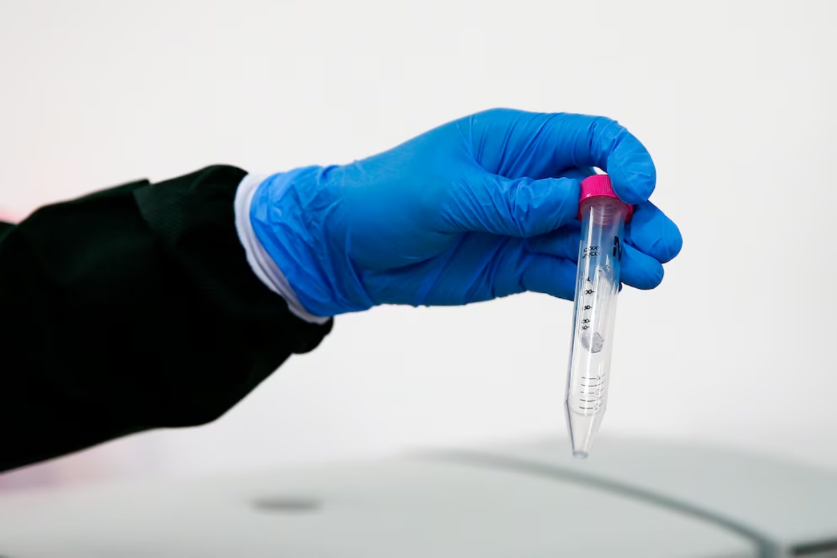 Nevjerojatno otkriće: Amoeba Incendiamoeba cascadensis prkosi granicama života u ekstremnim uvjetima! detail 3