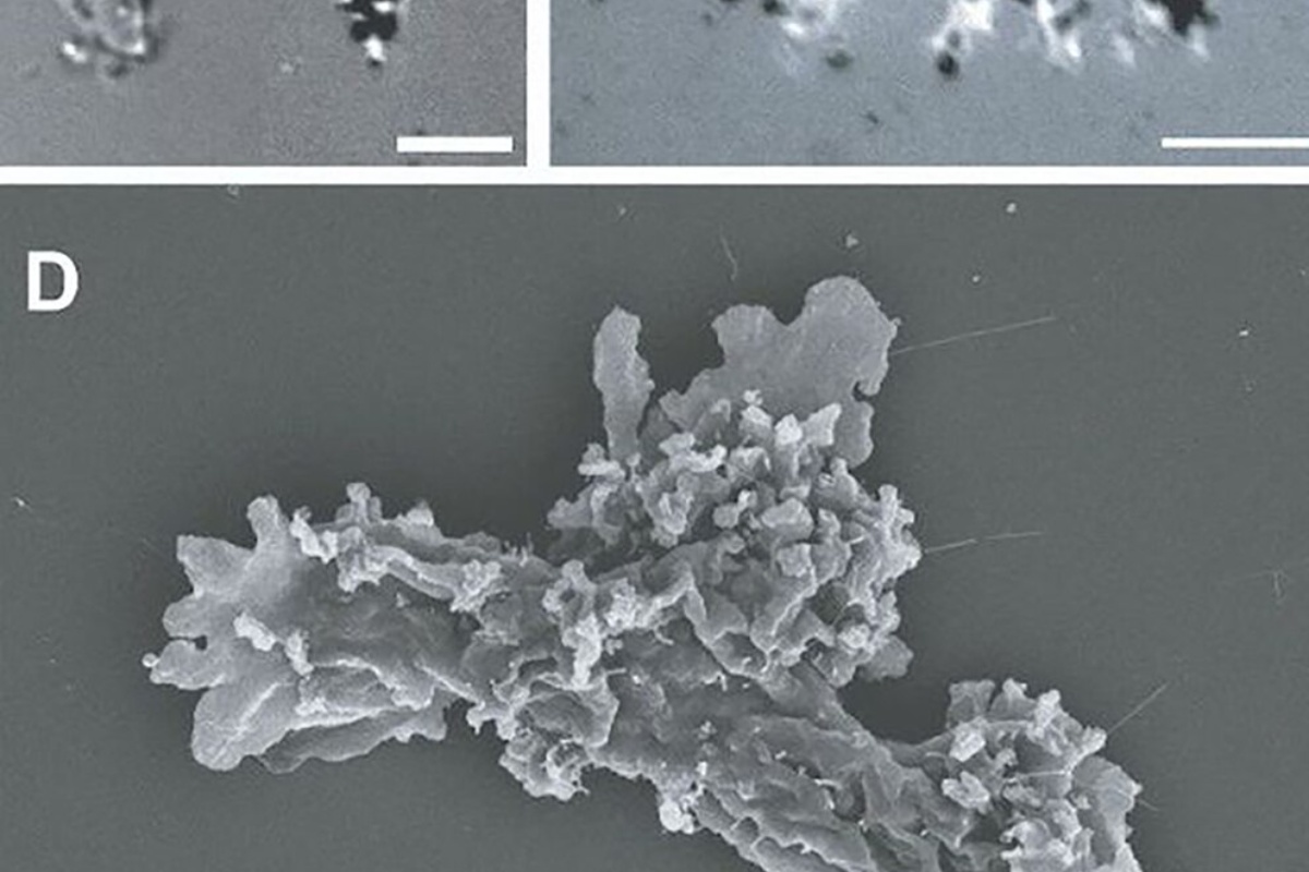 Nevjerojatno otkriće: Amoeba Incendiamoeba cascadensis prkosi granicama života u ekstremnim uvjetima! detail 5