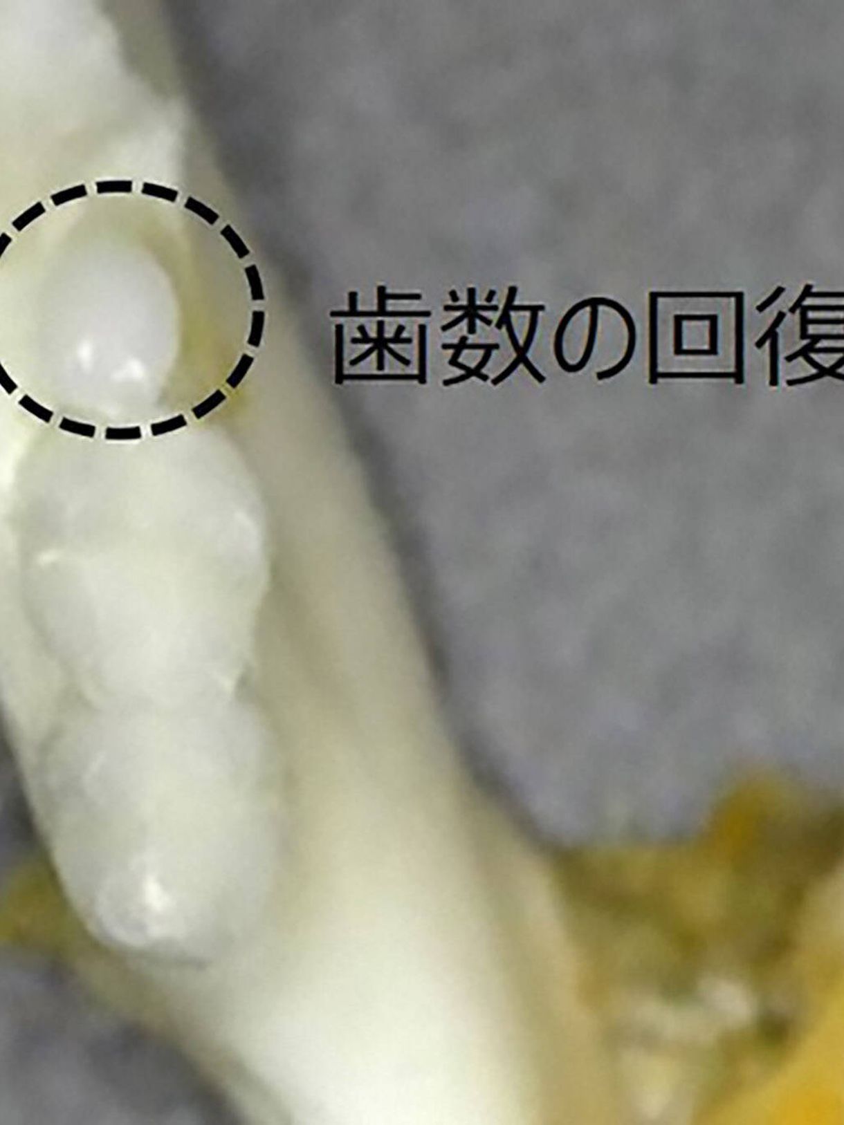 Lijek koji regenerira izgubljene zube mogao bi biti spreman za četiri godine