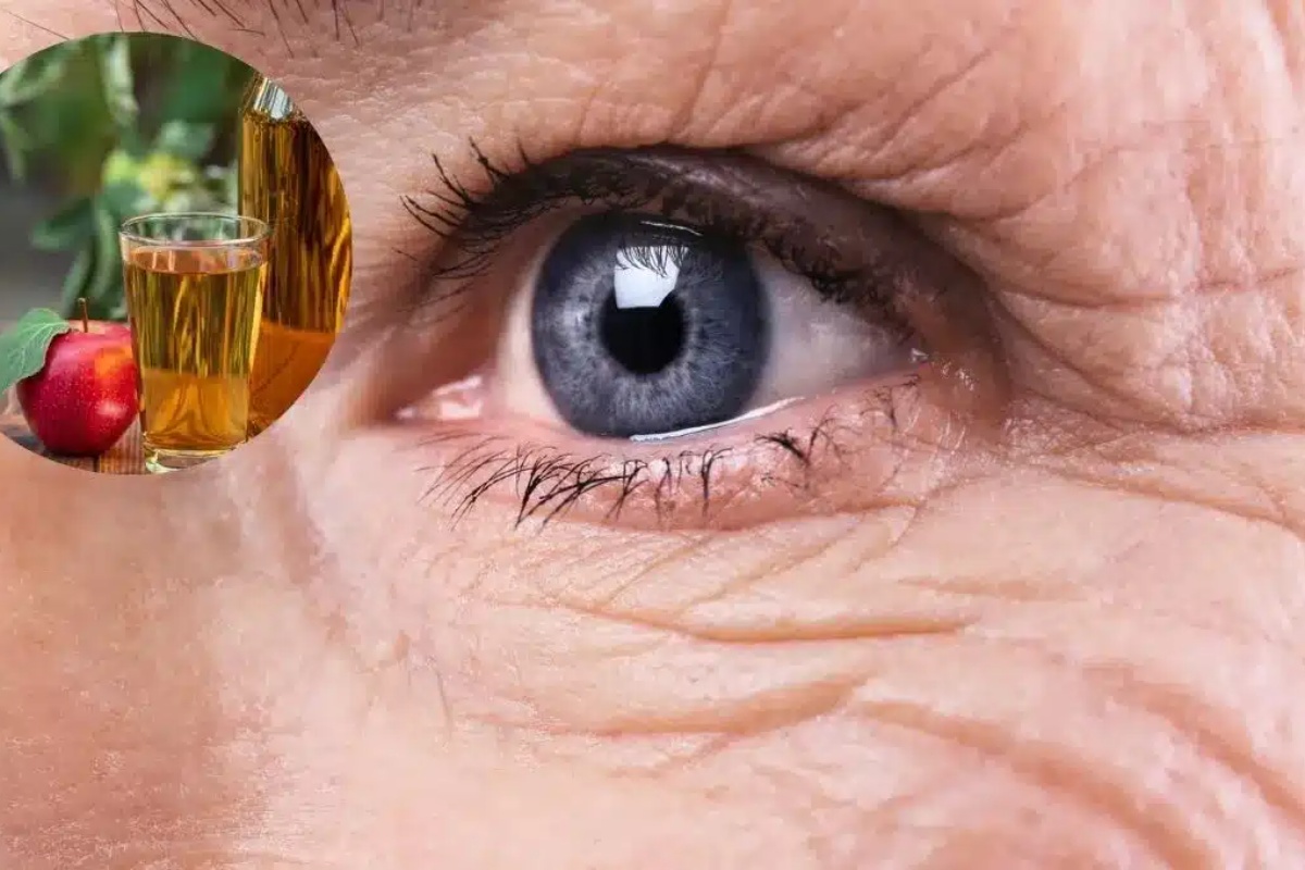 Kako se riješiti bora na licu uz malo jabučnog octa: učinkovit domaći kozmetički preparat. detail 2